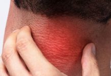 Domaći lijek za upalu grla koji rješava bol u roku od 2 sata