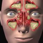 NAJBOLJI NAČIN DA OČISTITE SINUSE OD GNOJA I SLUZI: Za 10 dana ćete disati punim plućima! (RECEPT)