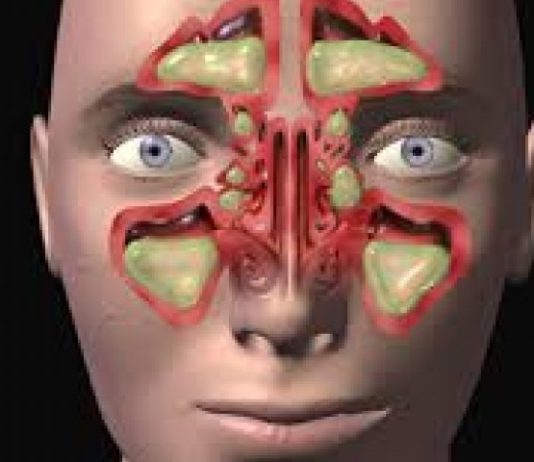 NAJBOLJI NAČIN DA OČISTITE SINUSE OD GNOJA I SLUZI: Za 10 dana ćete disati punim plućima! (RECEPT)